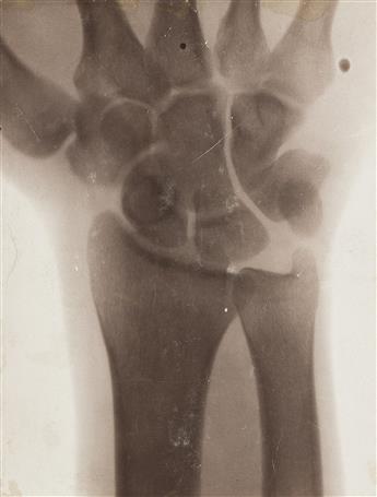 (X-RAYS) A small archive of 14 X-rays and related imagery documenting early use of the technology at Wesleyan University.